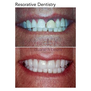 restorative-dentistry